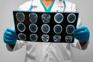Do You Know What To Expect From A Brain Injury?